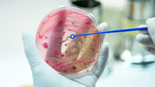 Close up of plate on hand medical technicians working on bacterial culture and drug resistance of pathogens in laboratory