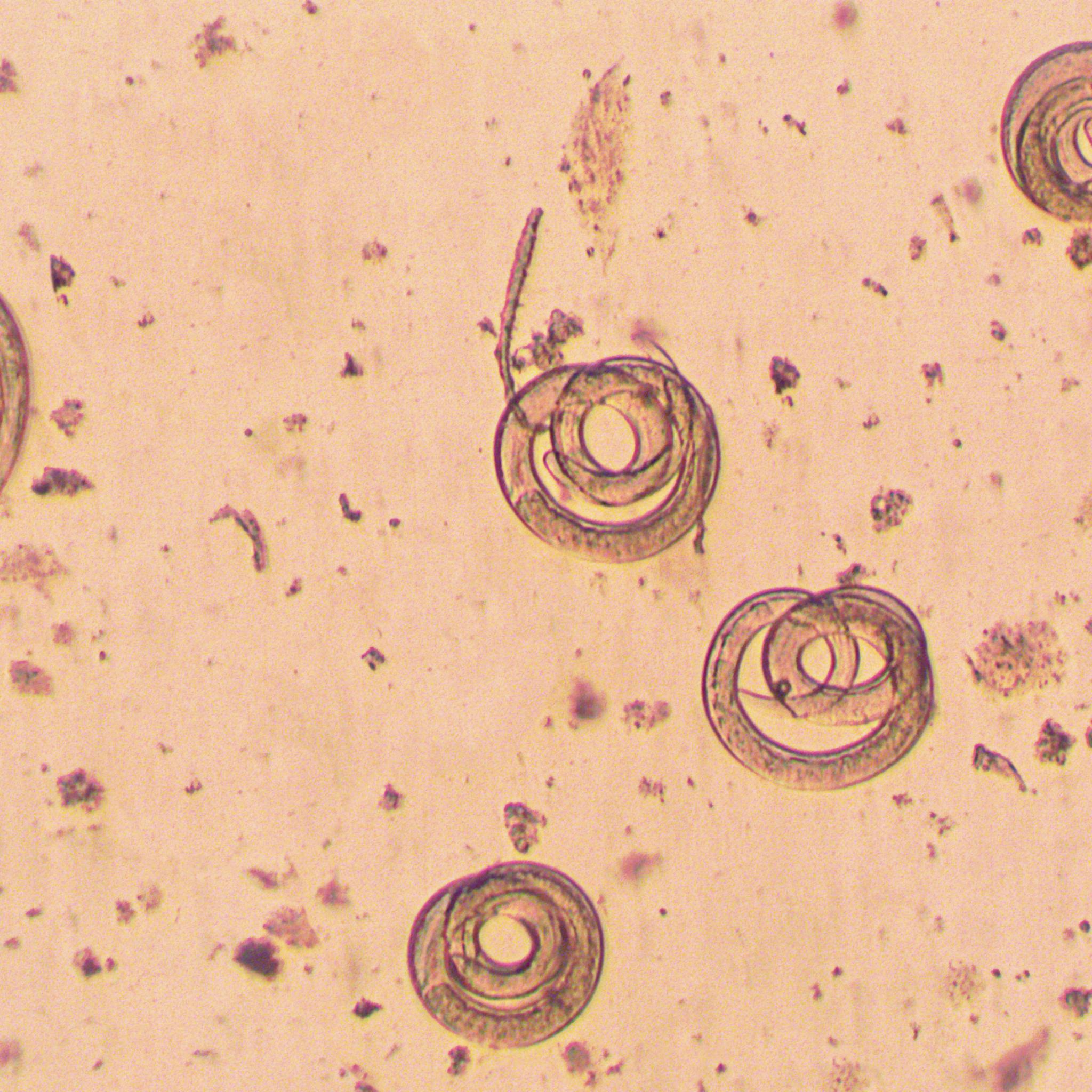 Трихинелла Спиралис в микроскопе