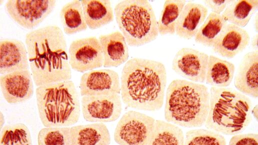 Micro-photo of tissue under a microscope